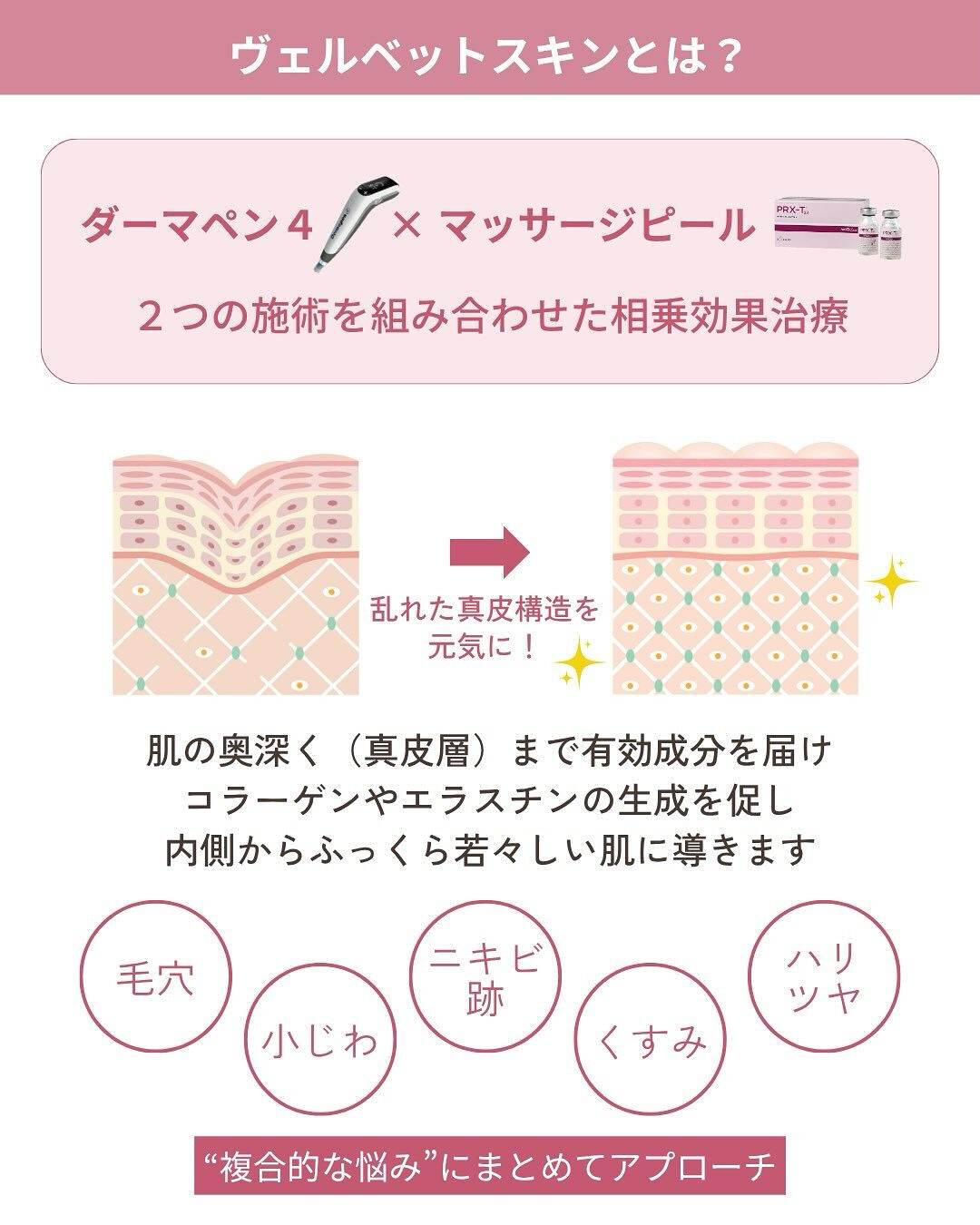 【ヴェルヴェットスキン✨】