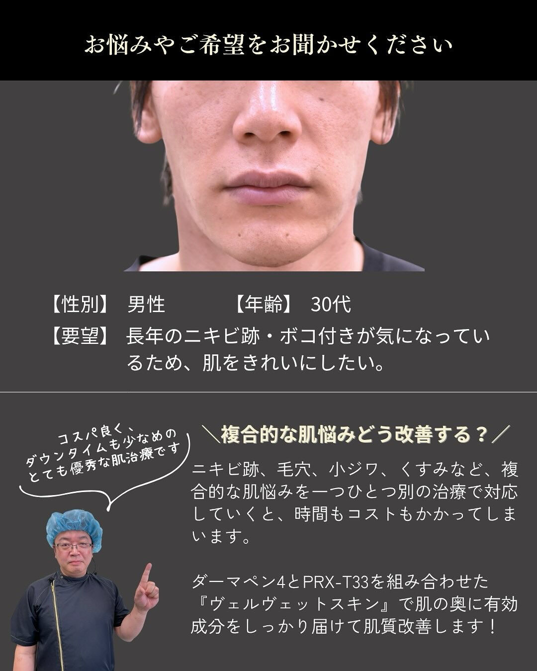 【ヴェルヴェットスキン症例✨】