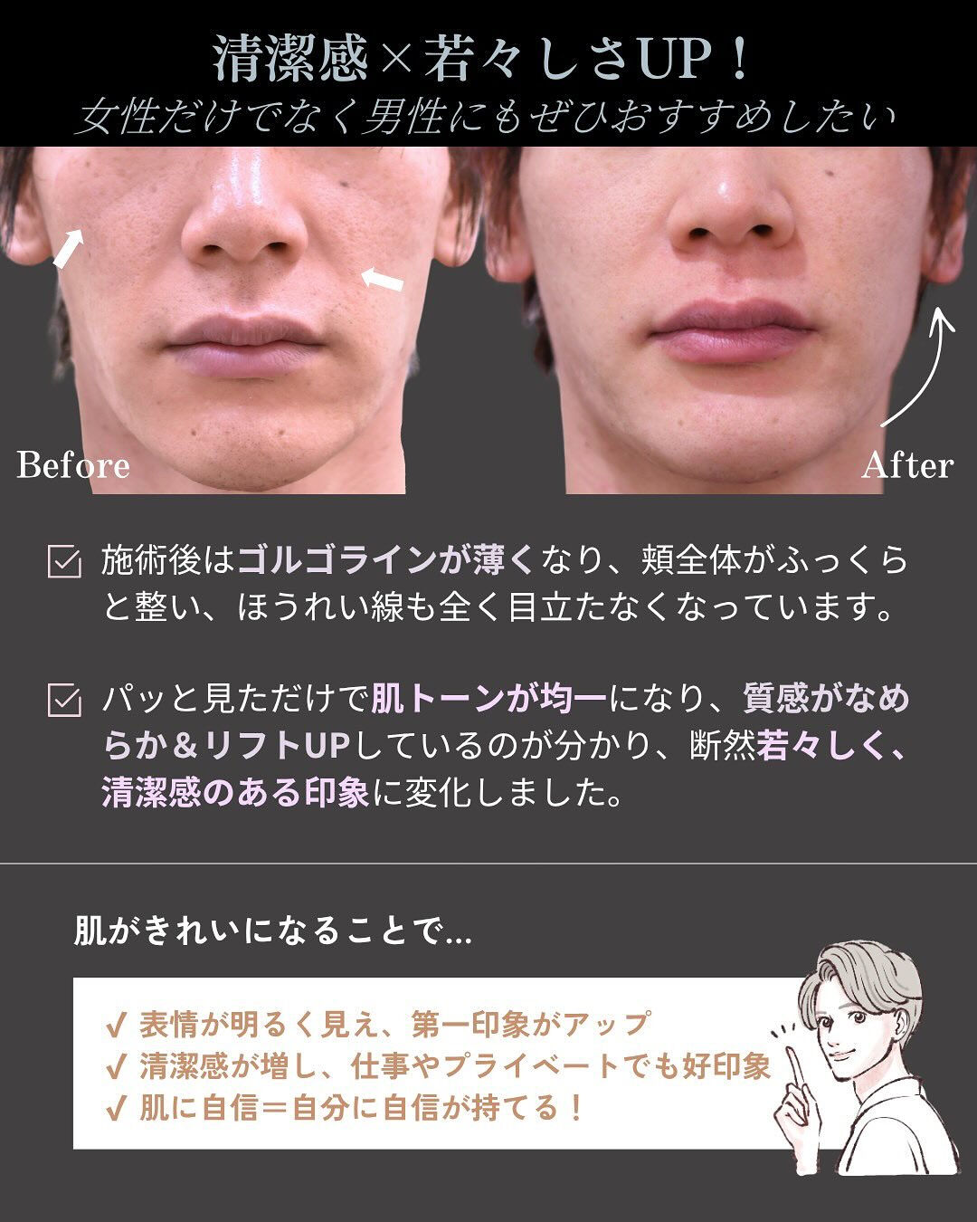 【ヴェルヴェットスキン症例✨】