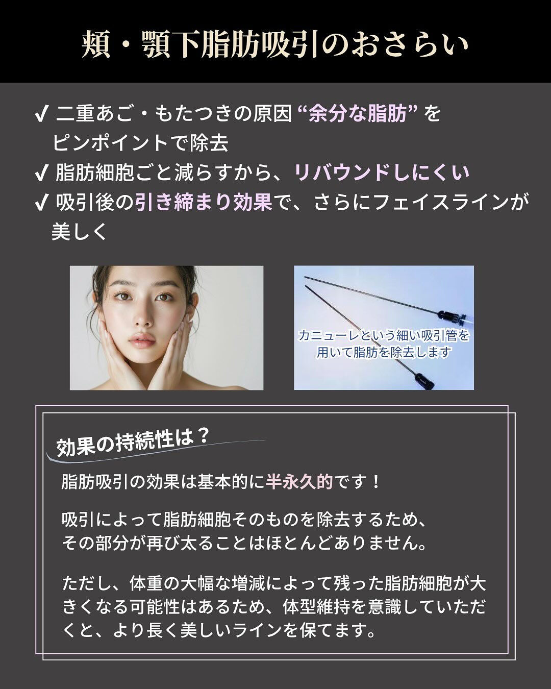 【頬・顎下脂肪吸引】