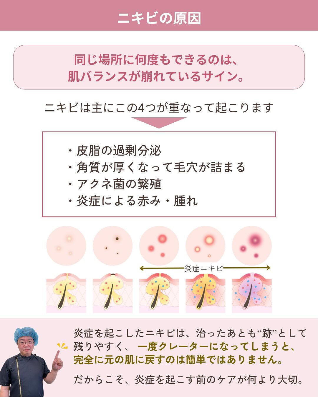 💬繰り返すニキビにお悩みではありませんか？