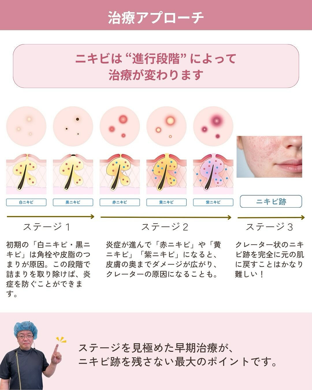 💬繰り返すニキビにお悩みではありませんか？