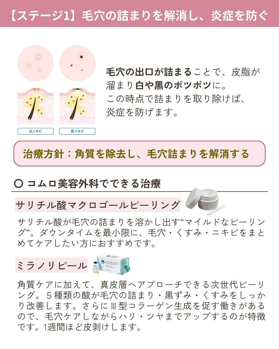 💬繰り返すニキビにお悩みではありませんか？