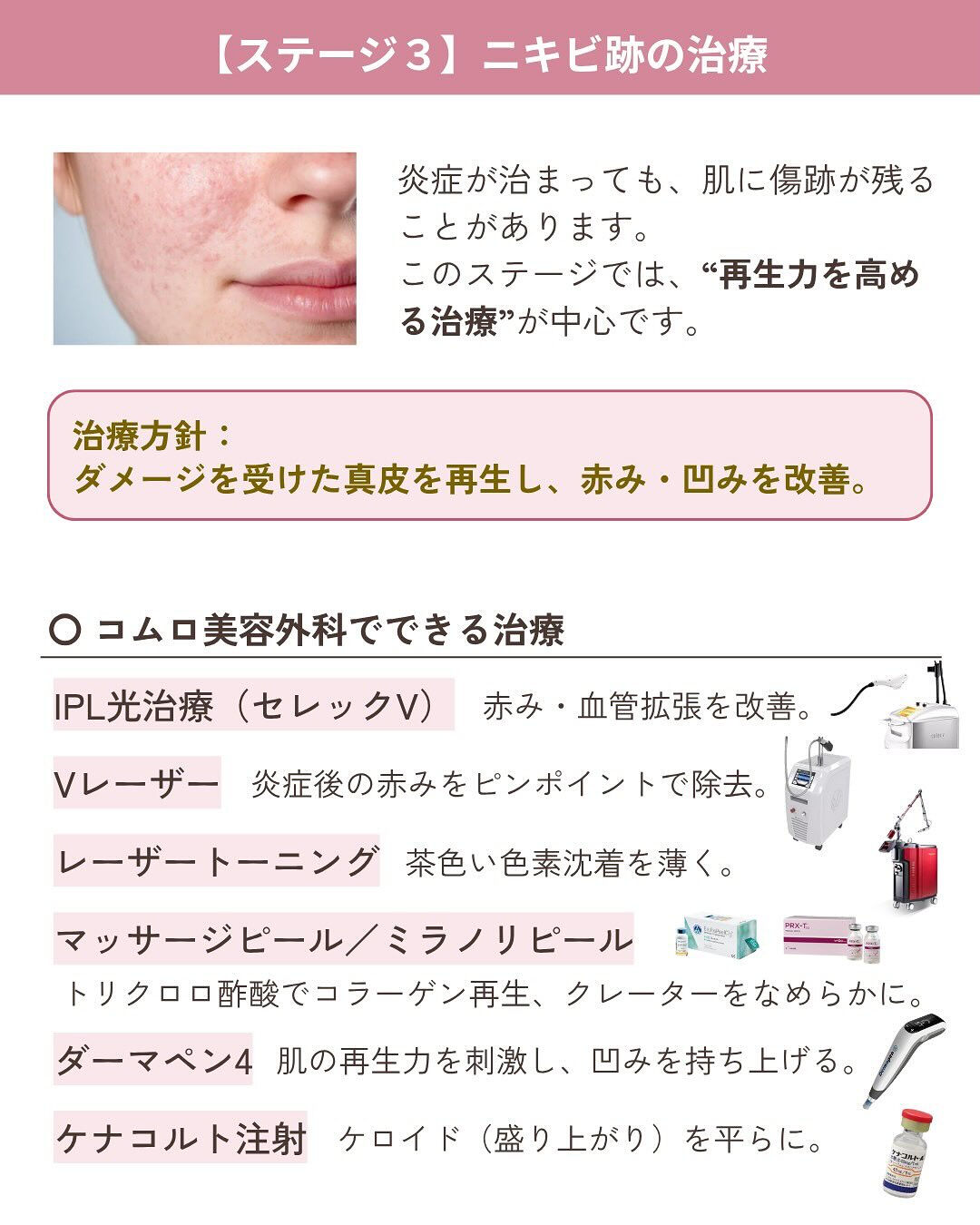 💬繰り返すニキビにお悩みではありませんか？