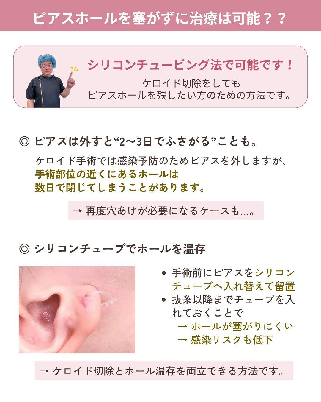 ピアスケロイド治療の気になるダウンタイムは？！