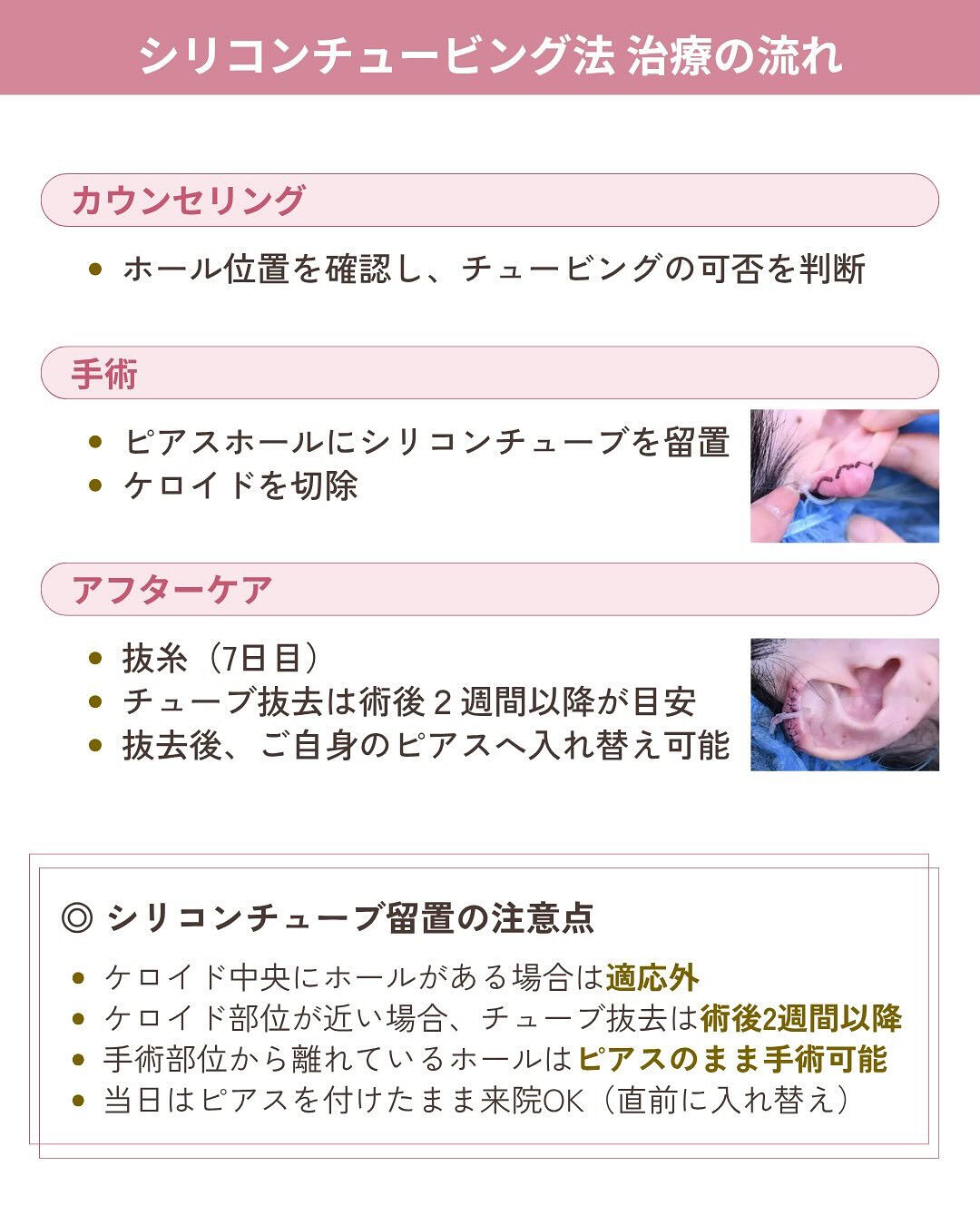 ピアスケロイド治療の気になるダウンタイムは？！