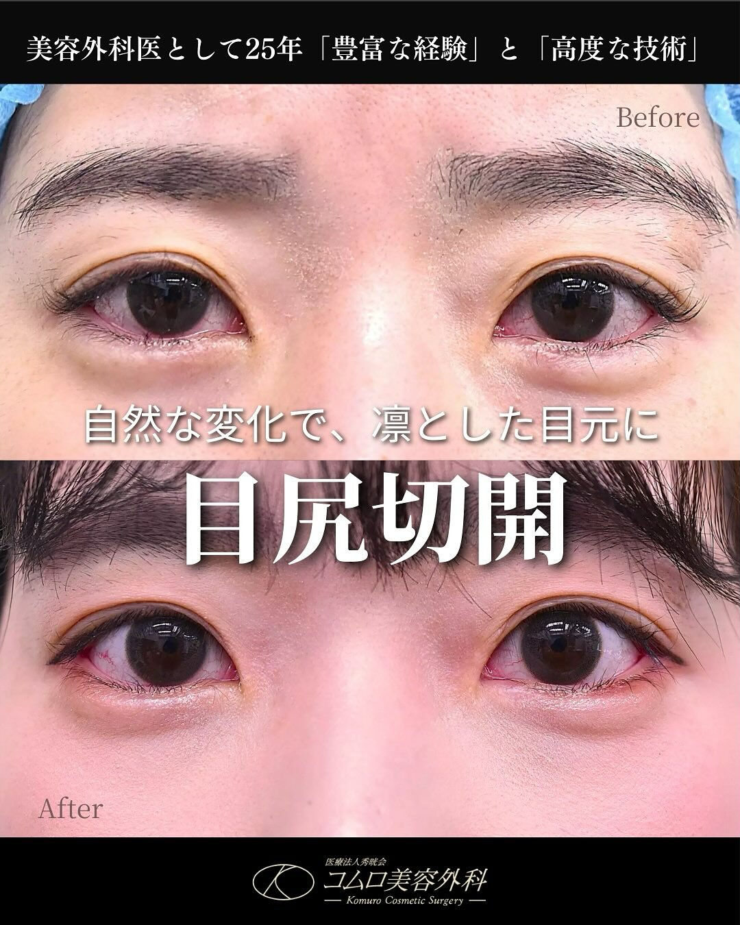 目の横幅のラインを整えることで、
