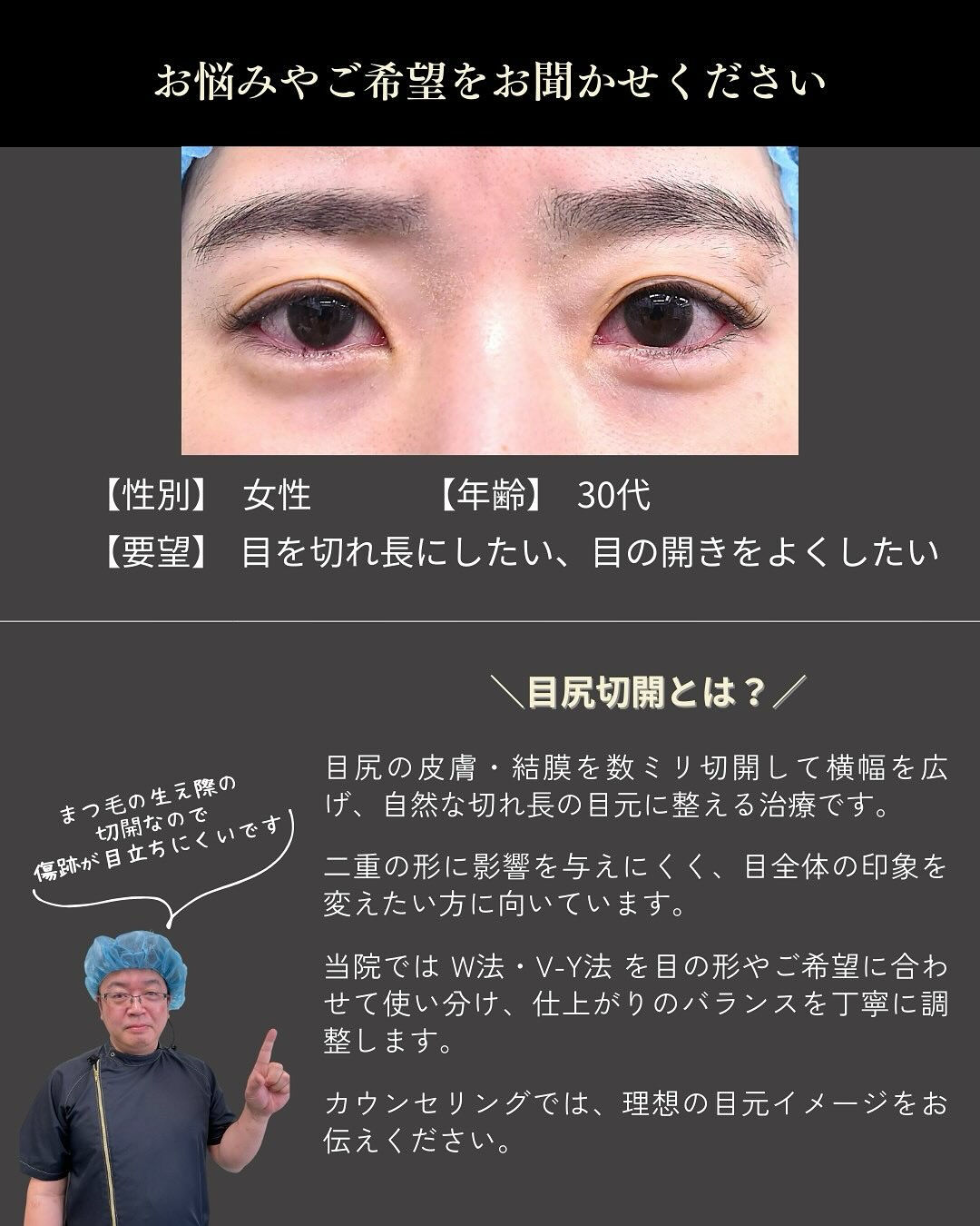目の横幅のラインを整えることで、