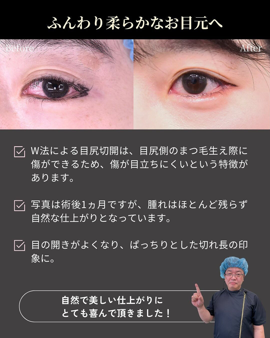 目の横幅のラインを整えることで、