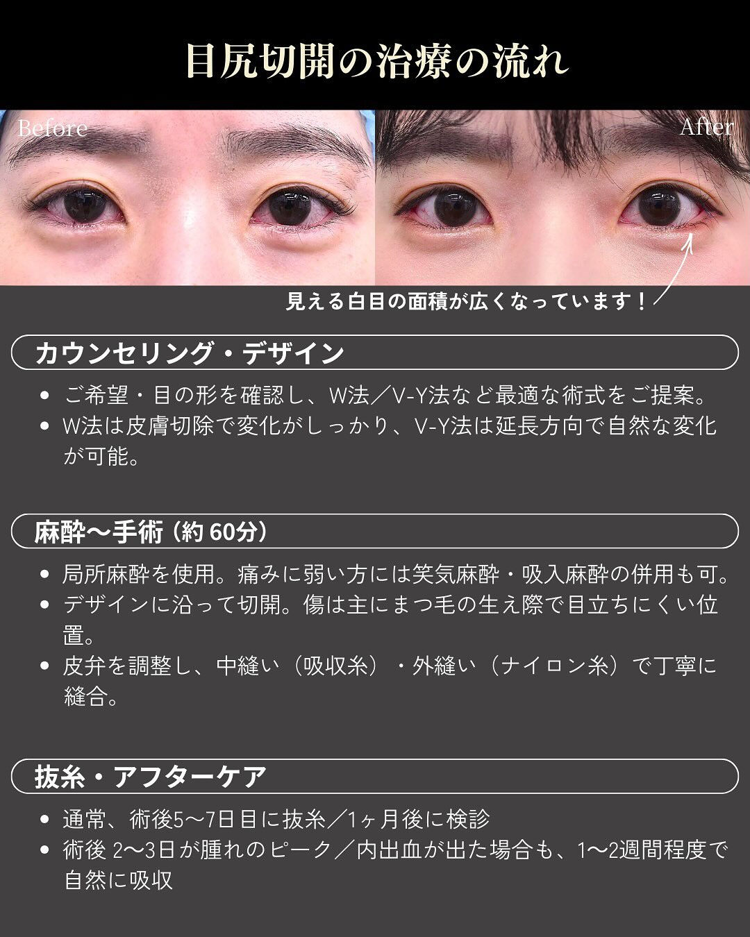目の横幅のラインを整えることで、