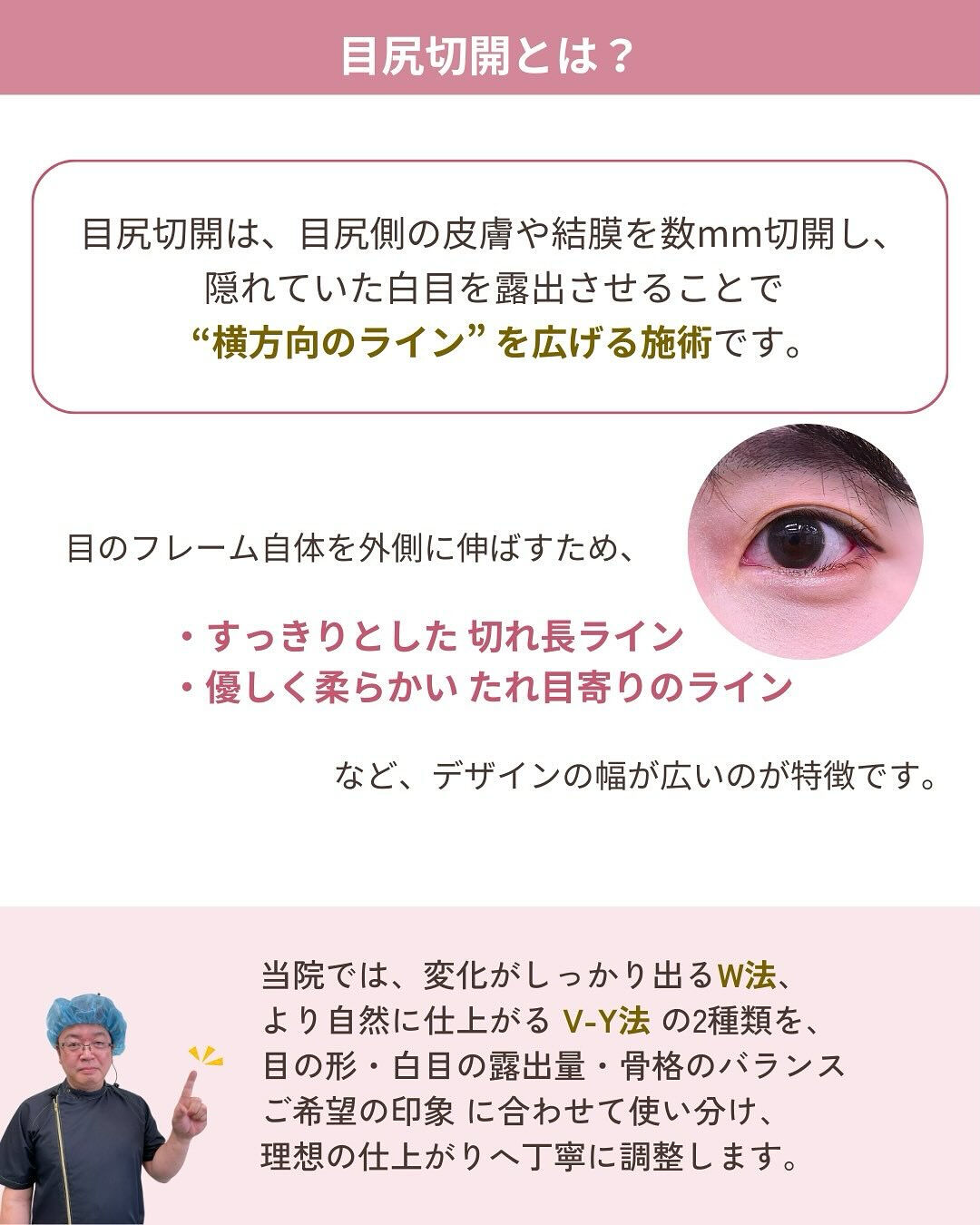 目尻切開は、
