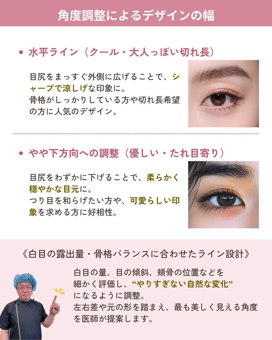 目尻切開は、