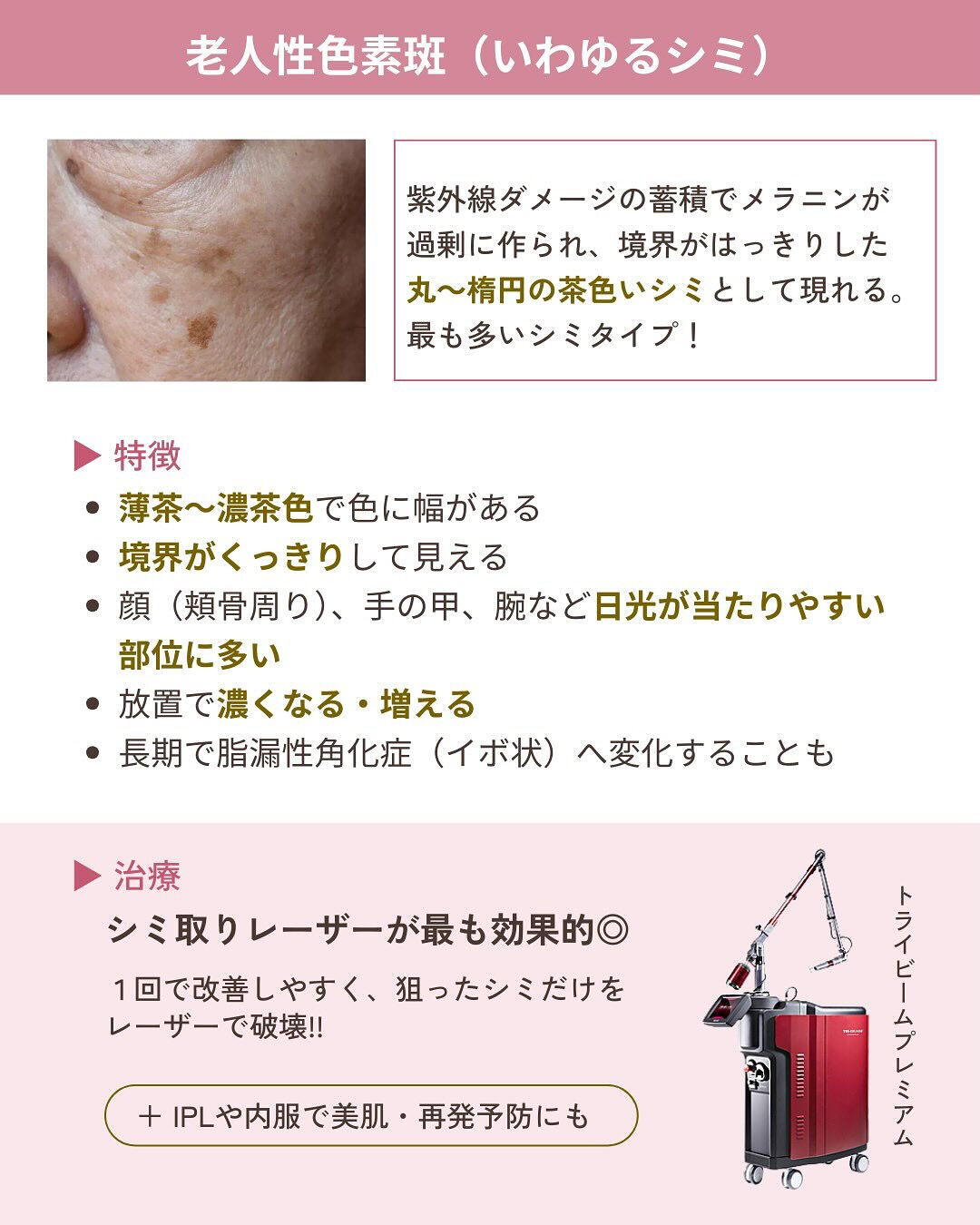 そのシミ、本当に同じ治療でいい？
