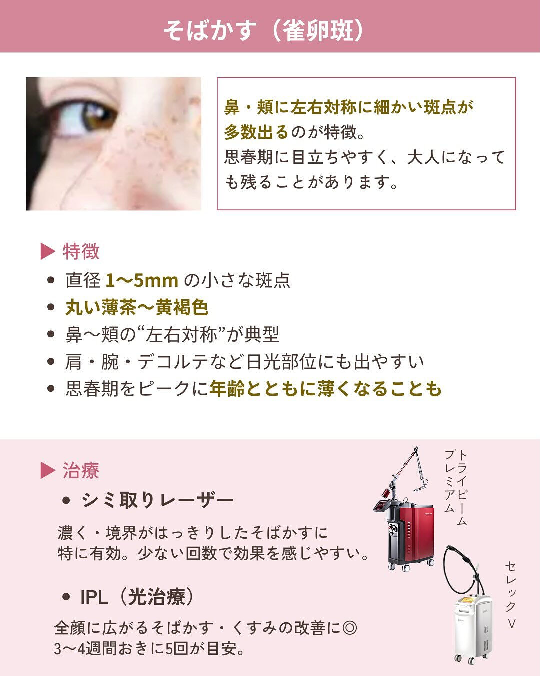 そのシミ、本当に同じ治療でいい？
