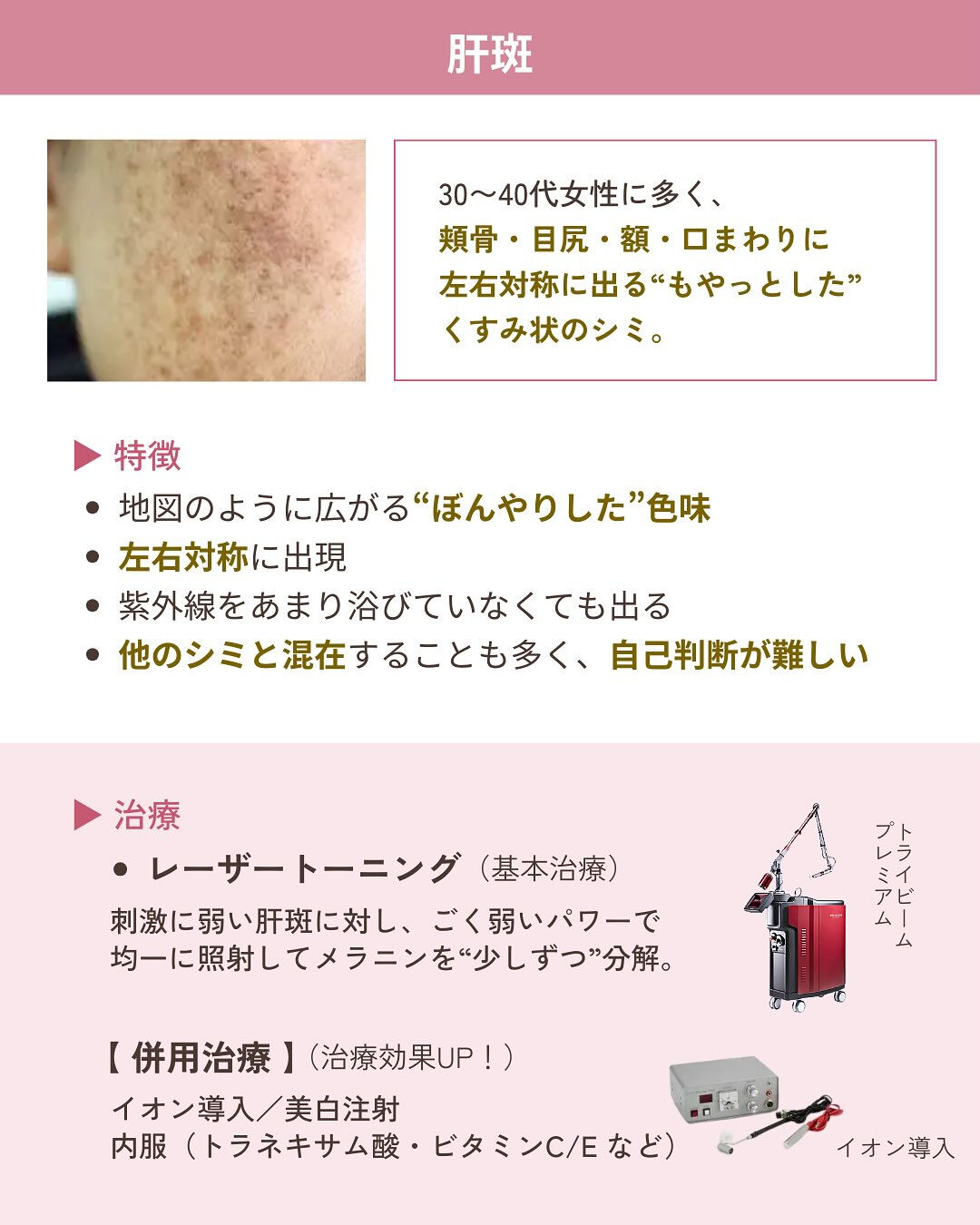 そのシミ、本当に同じ治療でいい？