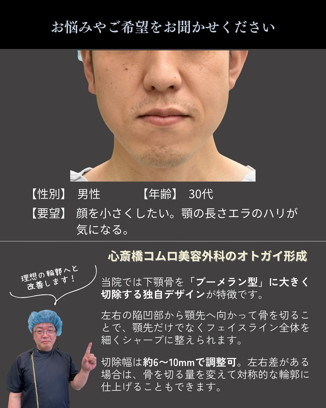 顎骨切り+エラ削り症例✨