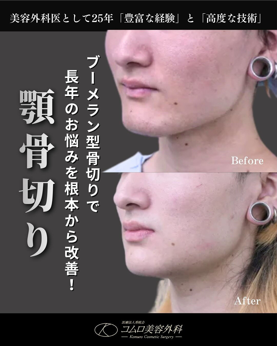 お顔の印象を大きく左右する「顎のライン」