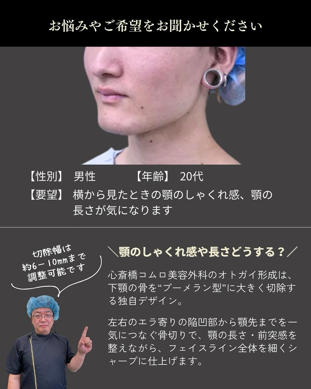 お顔の印象を大きく左右する「顎のライン」