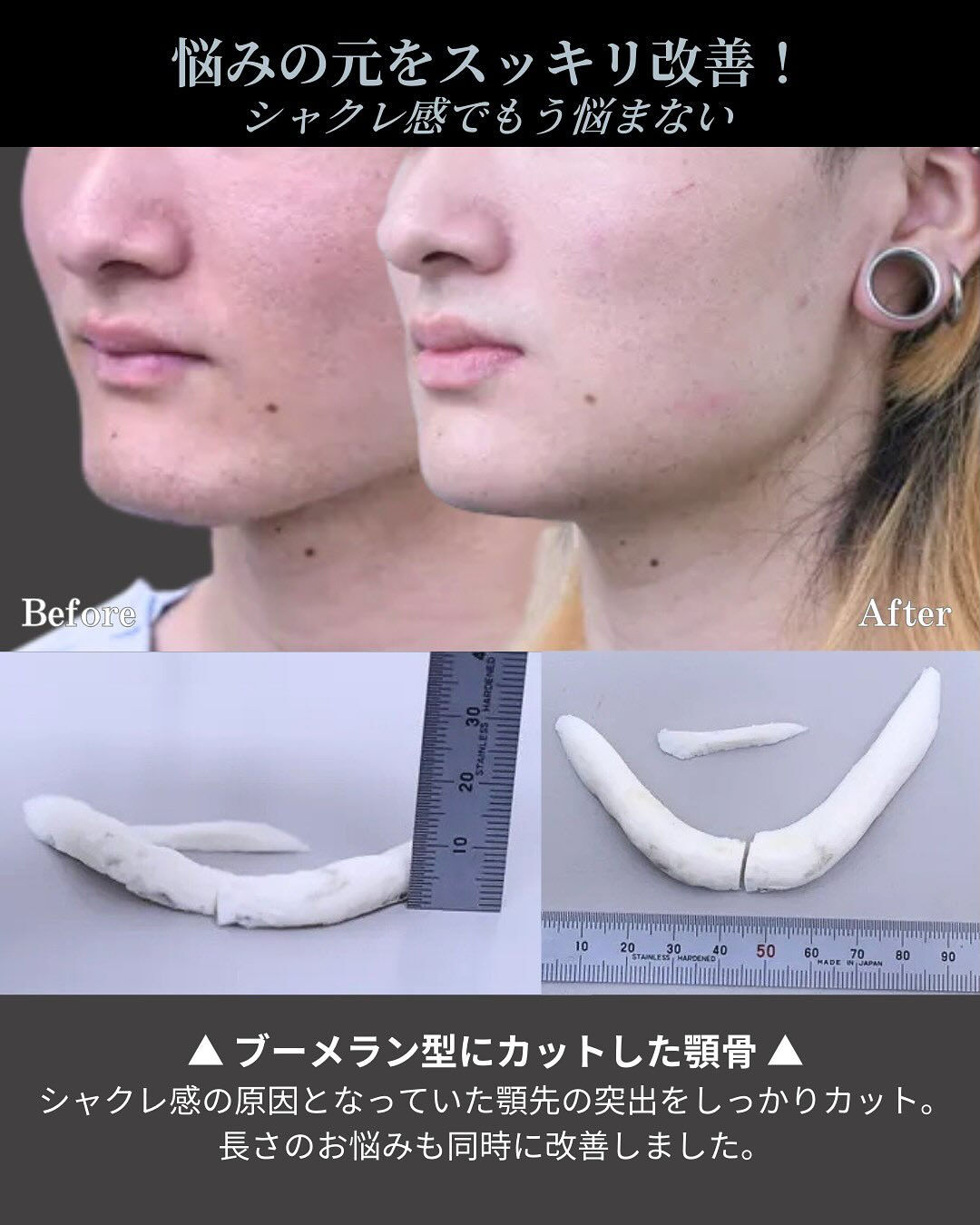 お顔の印象を大きく左右する「顎のライン」