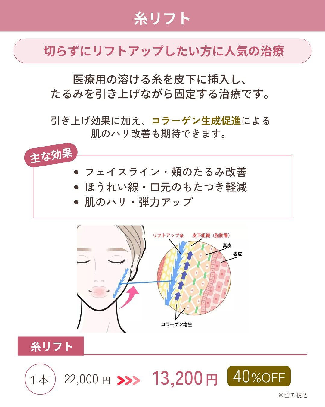 🎍✨ 1月限定｜お年玉キャンペーン ✨🎍