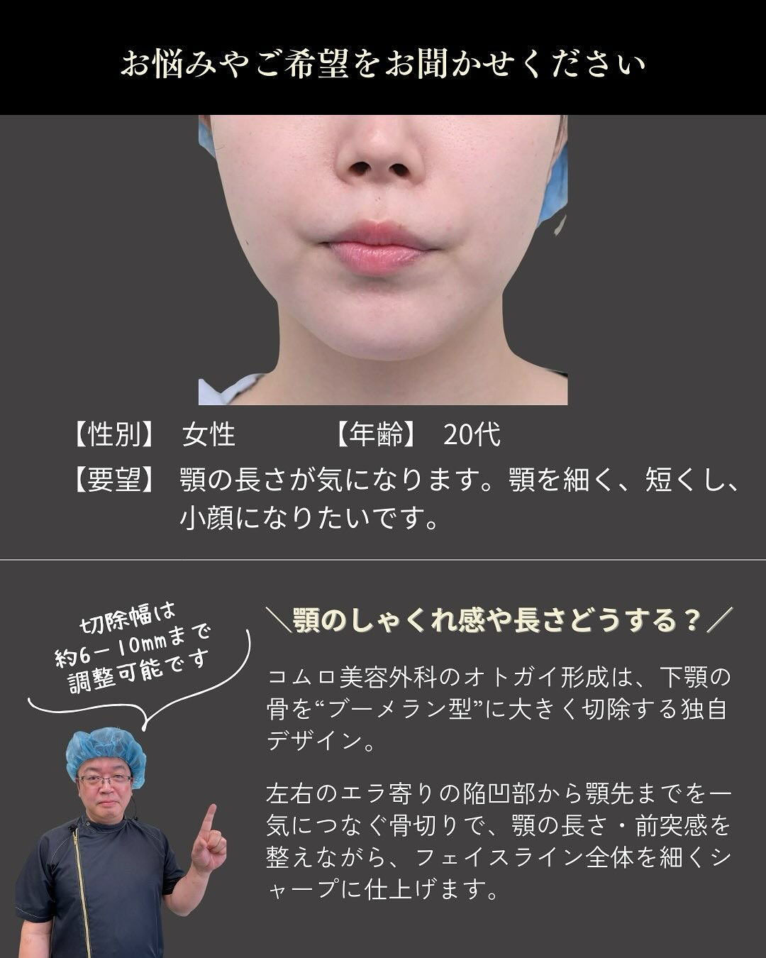 顎を細く短くしたい！