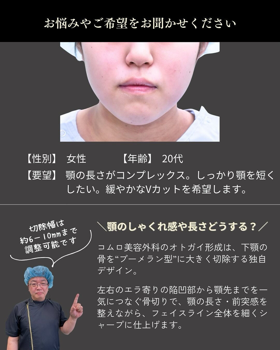 20代女性の下顎骨骨切り症例です👨‍⚕️