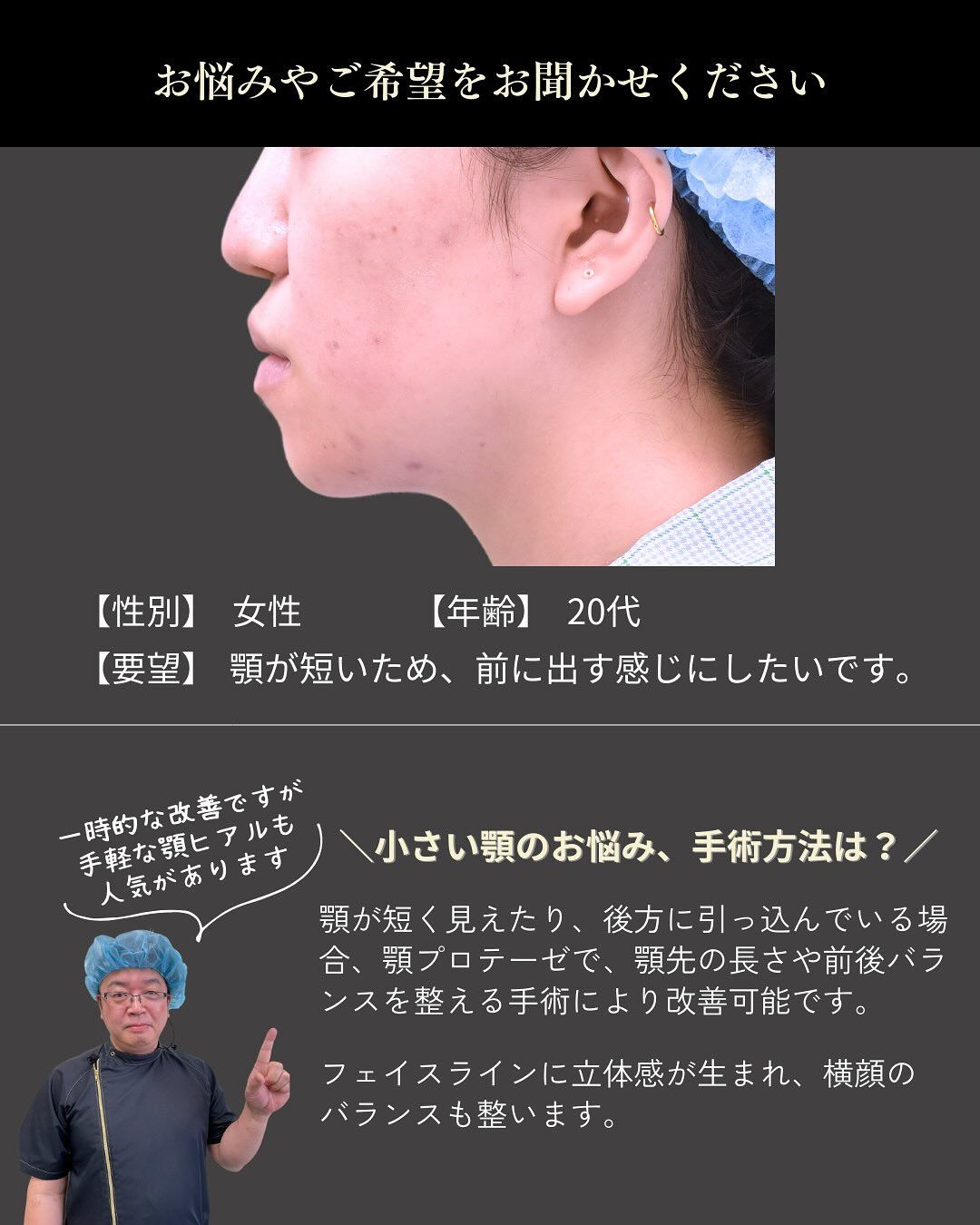 下顎形成症例👨‍⚕️