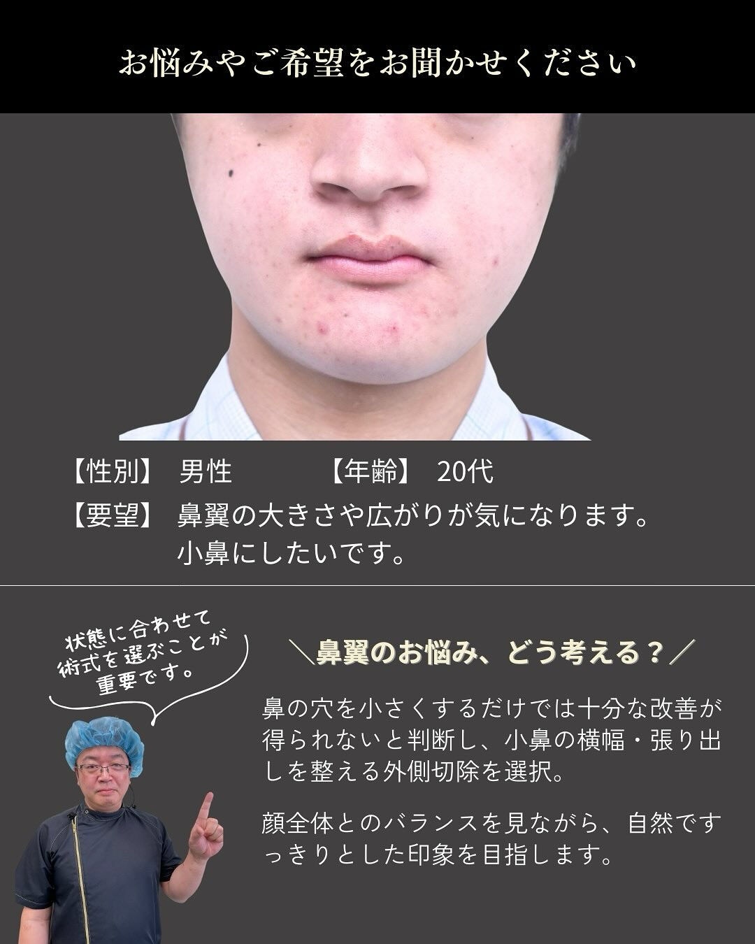 小鼻の横幅や広がりが気になる方へ