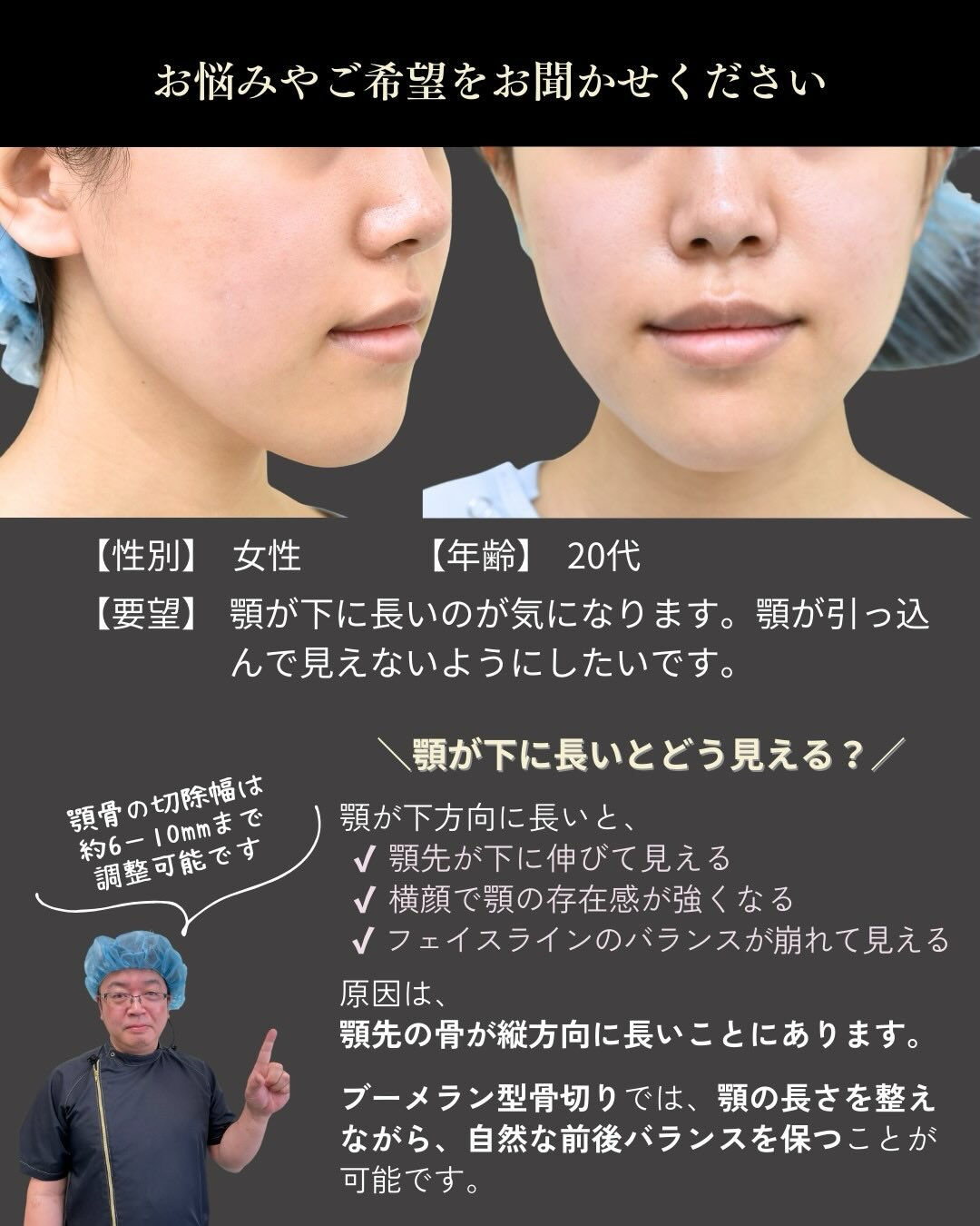 顎の長さや形は、顔全体のバランスを大きく左右する重要な要素で