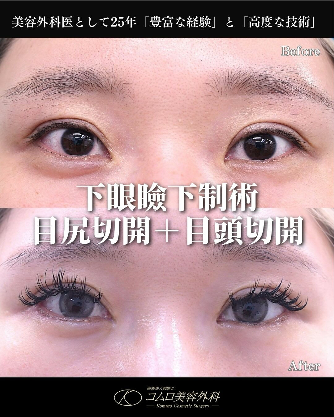目を大きく見せたいというご希望で、
