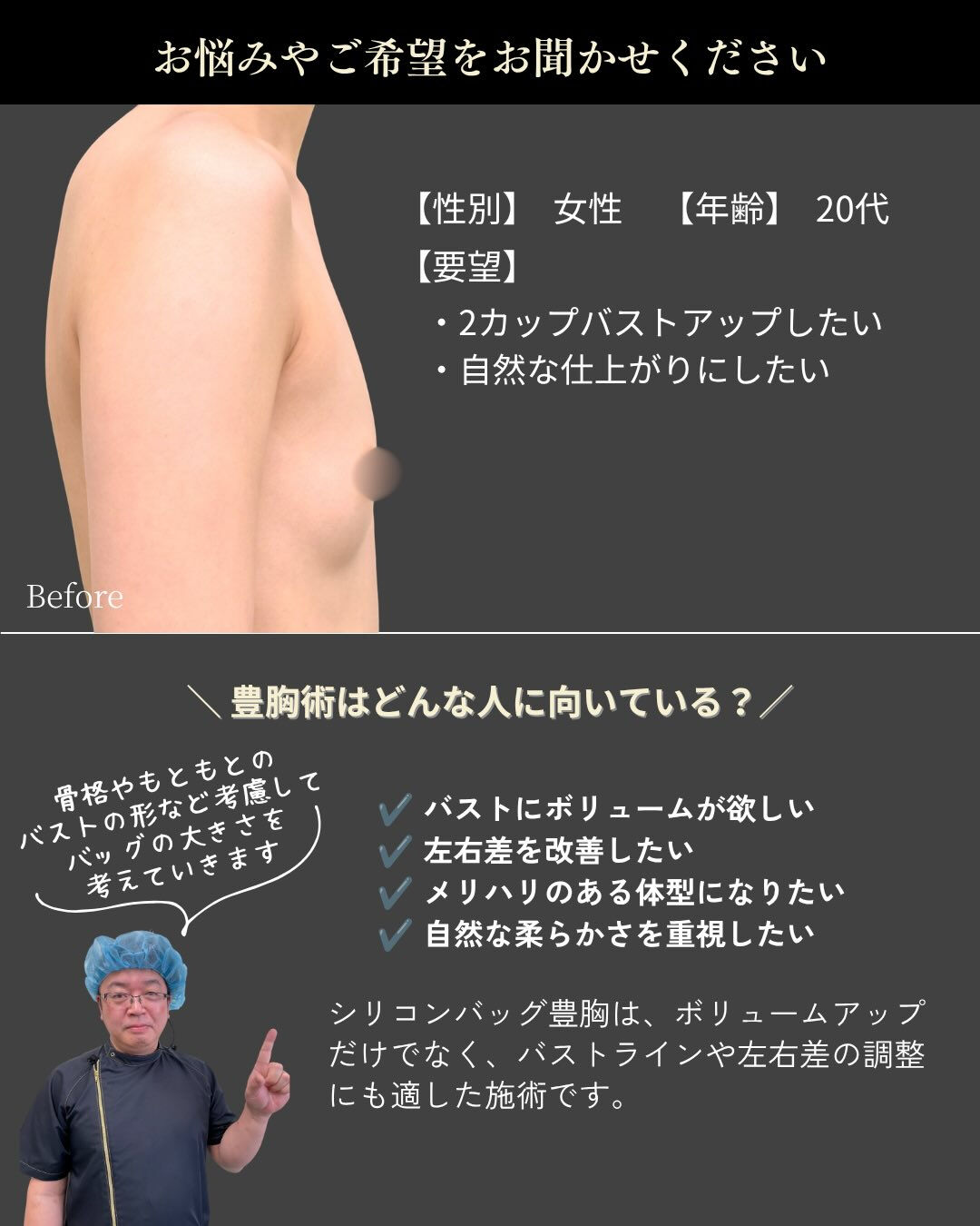 【モティバ豊胸症例】