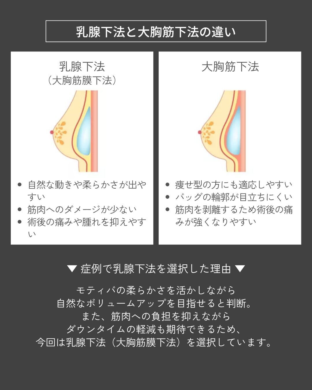 【モティバ豊胸症例】