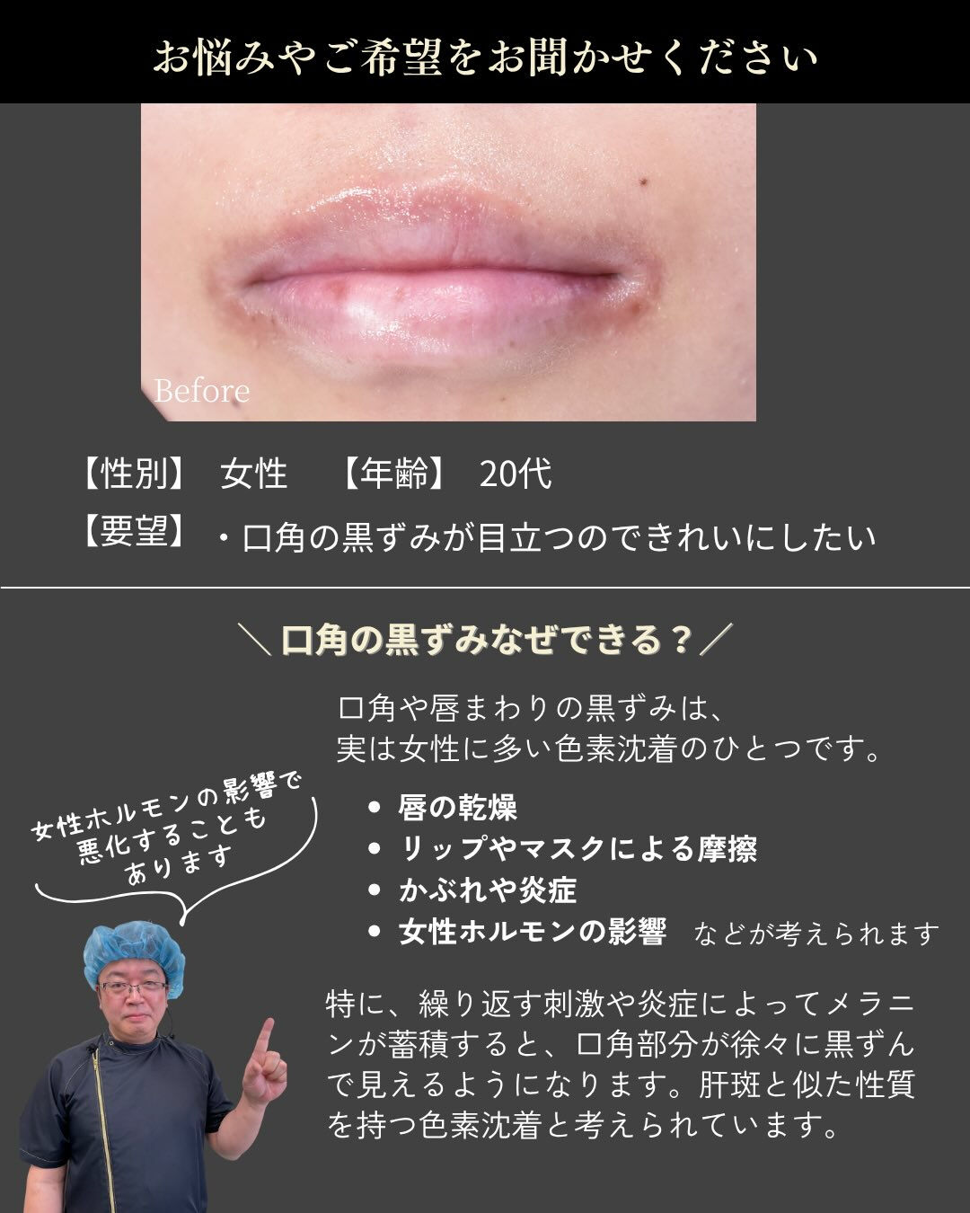 気になる口角の黒ずみ、あきらめていませんか？💋