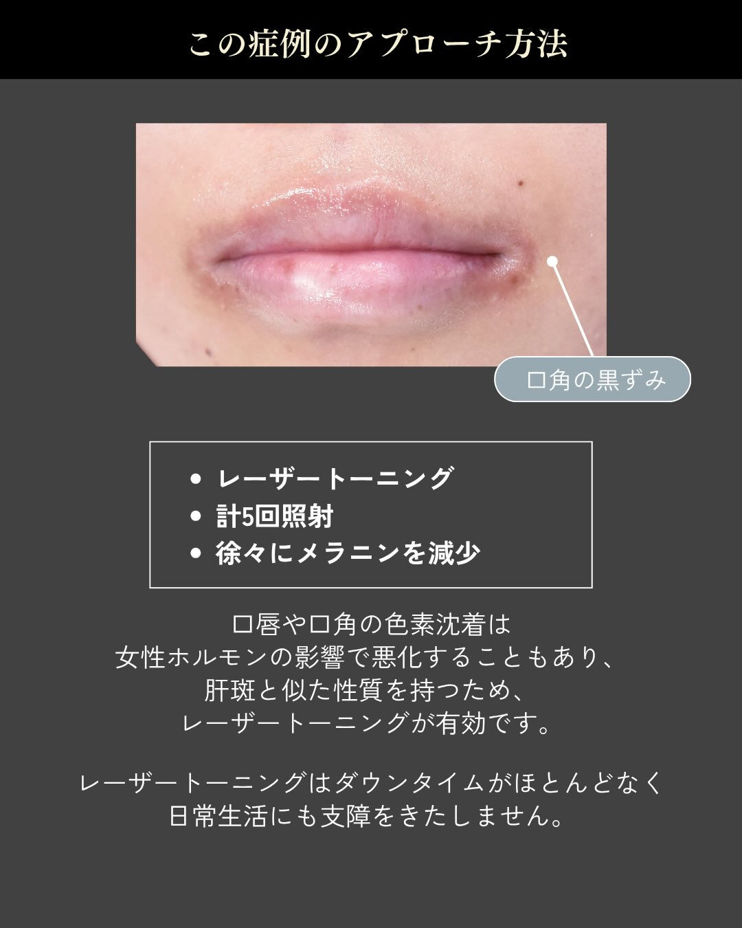 気になる口角の黒ずみ、あきらめていませんか？💋