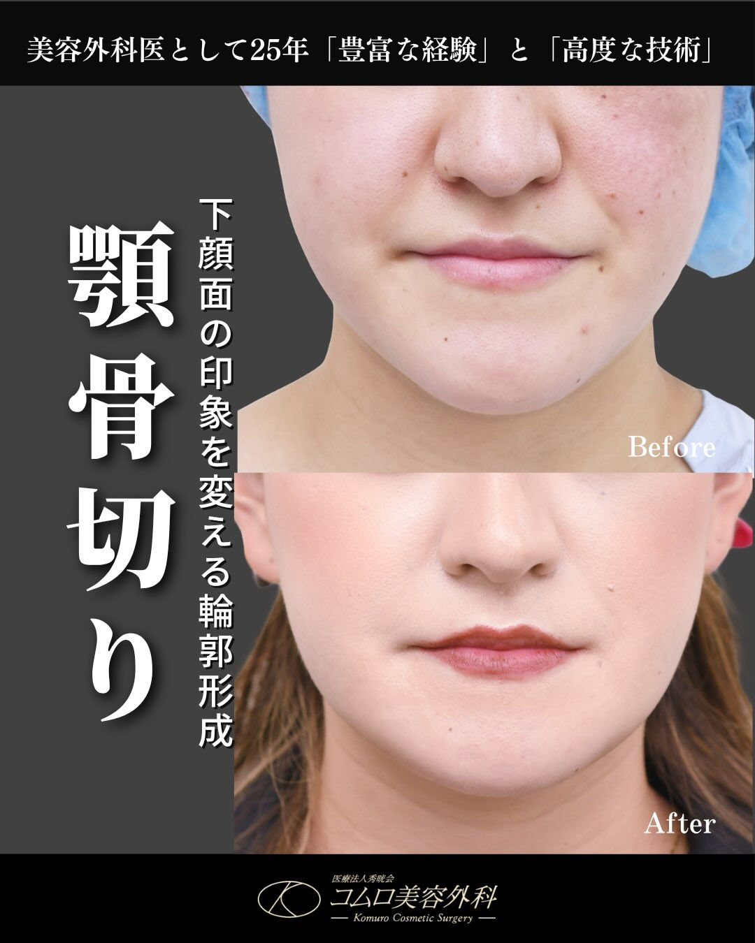 顎の長さや顔の大きさが気になる方へ