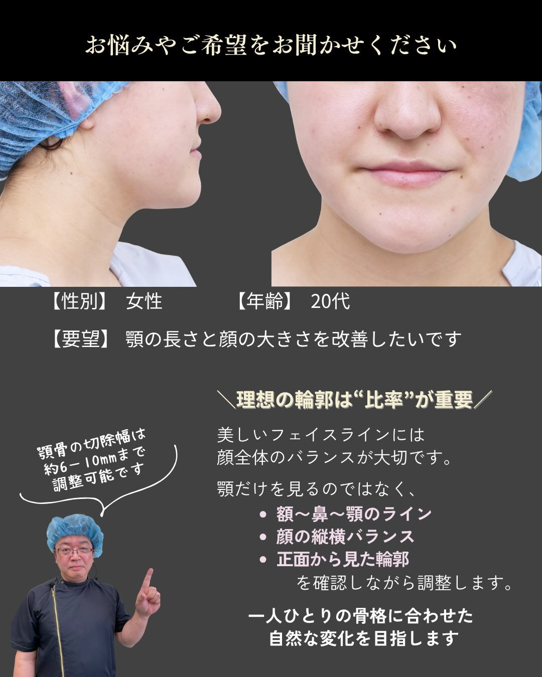 顎の長さや顔の大きさが気になる方へ