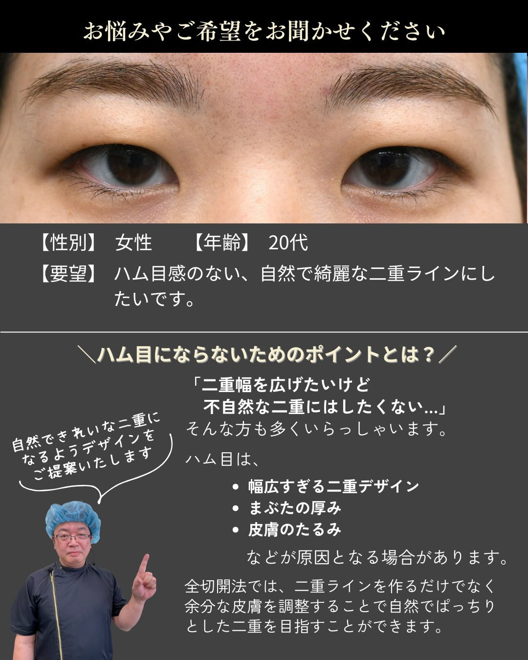 「二重幅を広げたい」