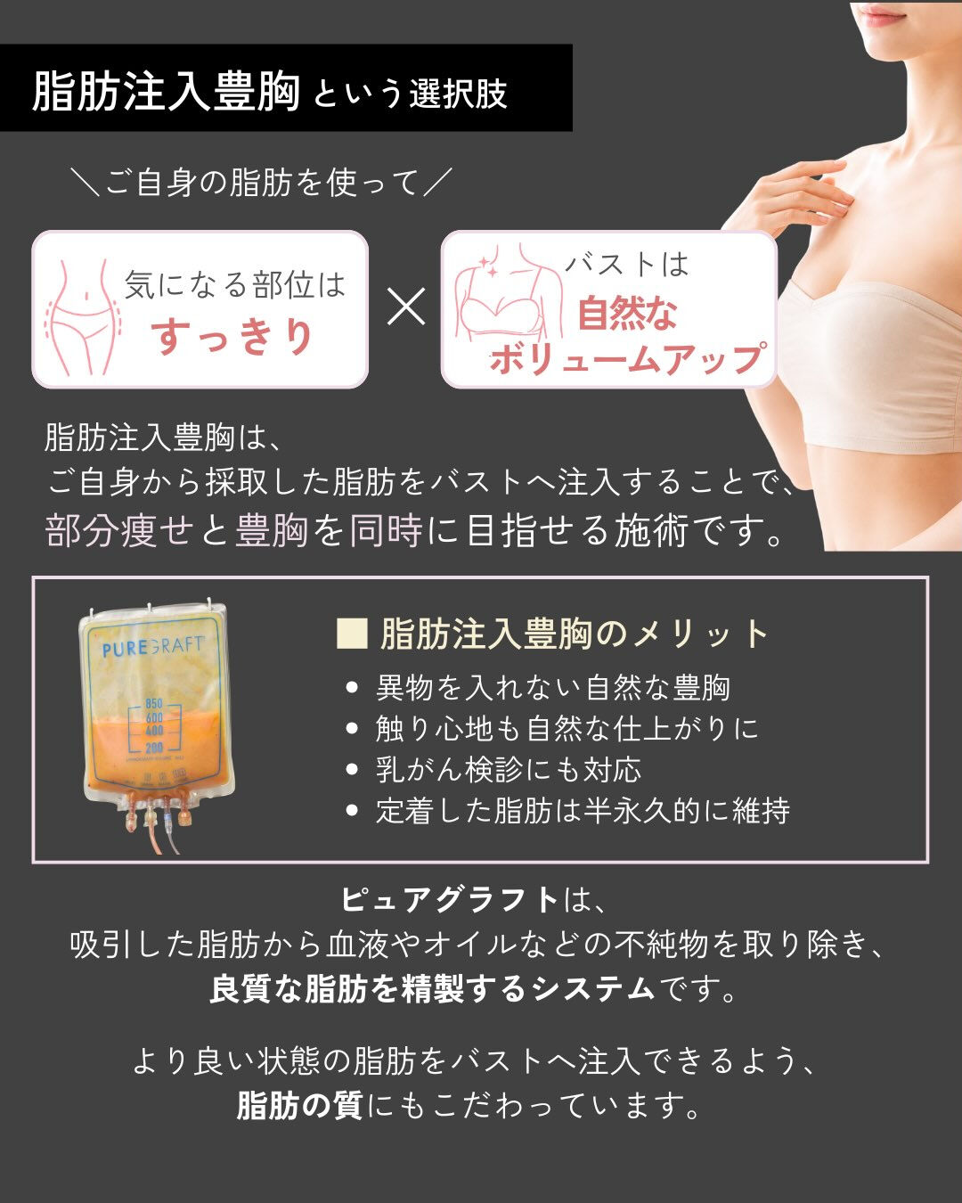 【脂肪注入豊胸のための大腿全周脂肪吸引】
