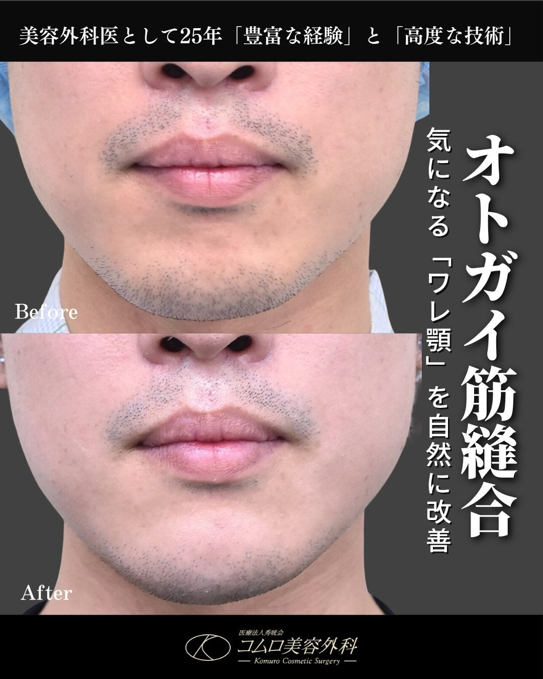 【ワレ顎は「骨」だけが原因とは限りません】