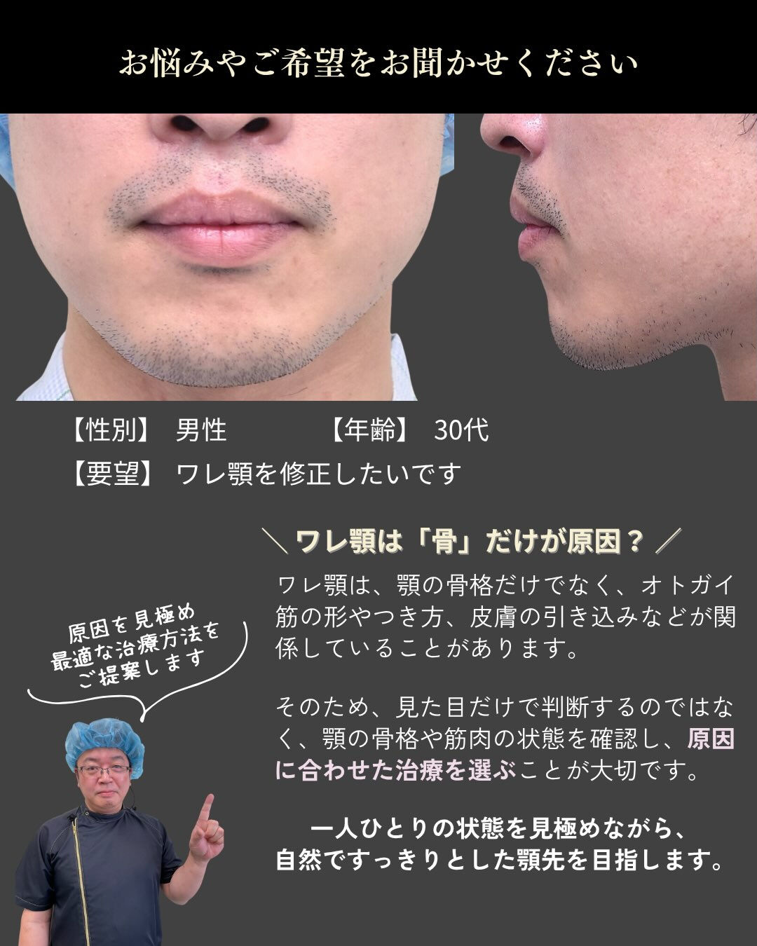 【ワレ顎は「骨」だけが原因とは限りません】