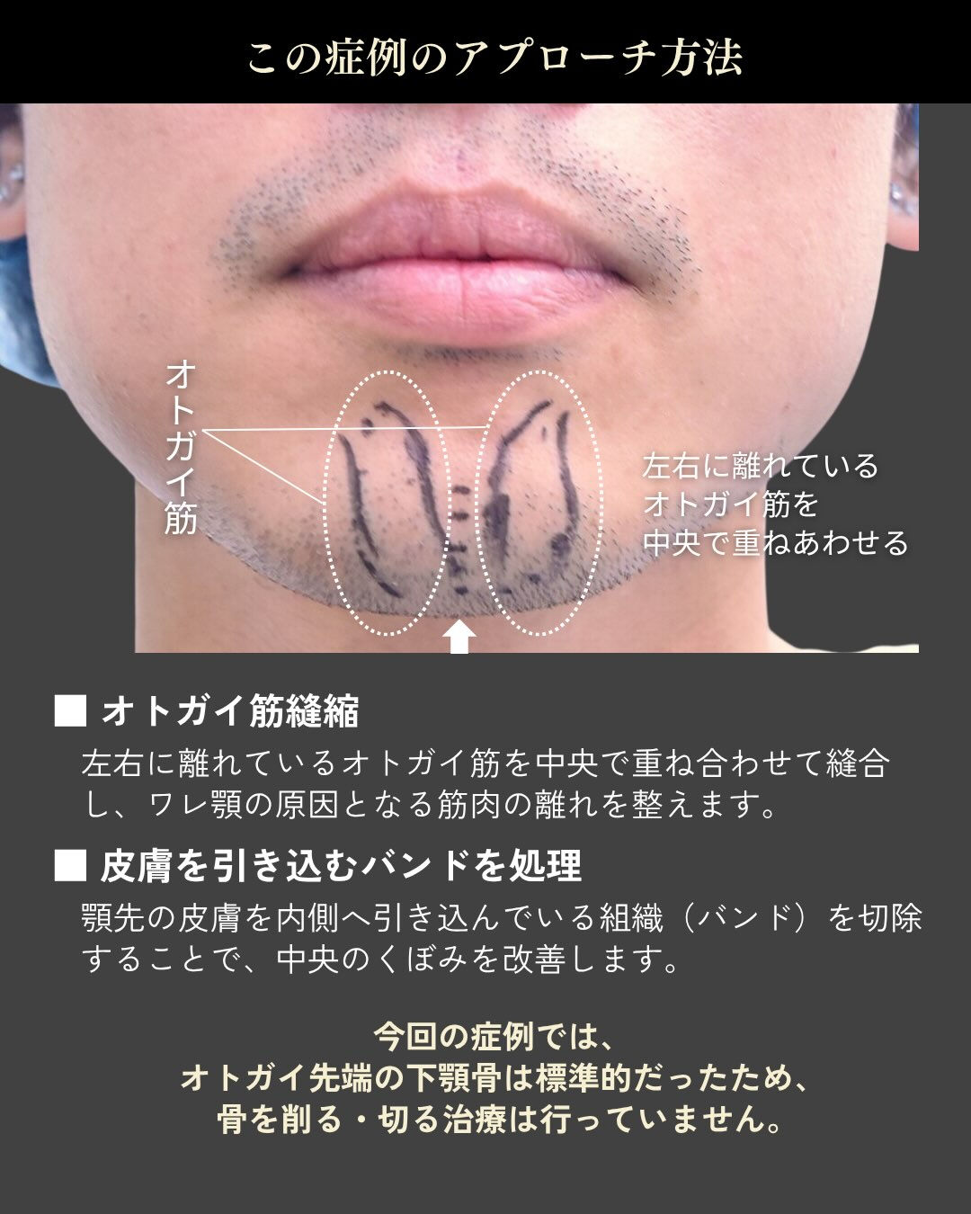 【ワレ顎は「骨」だけが原因とは限りません】