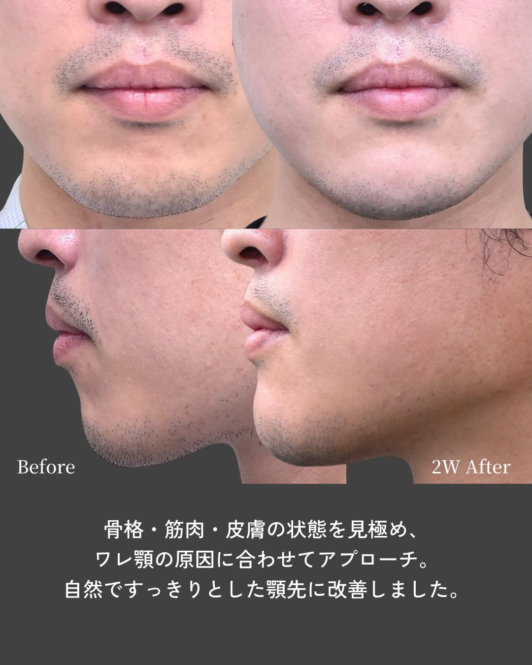 【ワレ顎は「骨」だけが原因とは限りません】